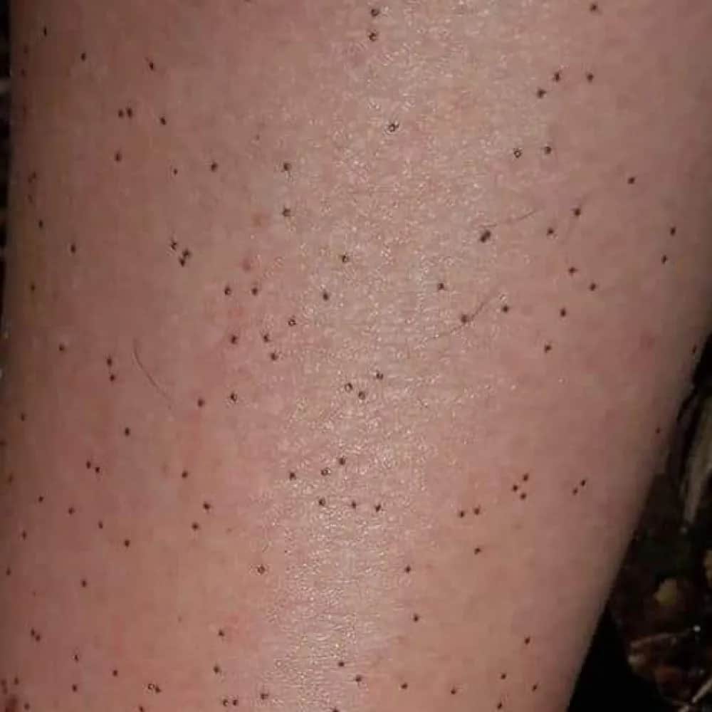 Jak wygląda mały kleszcz i jak go rozpoznać, by uniknąć zagrożenia